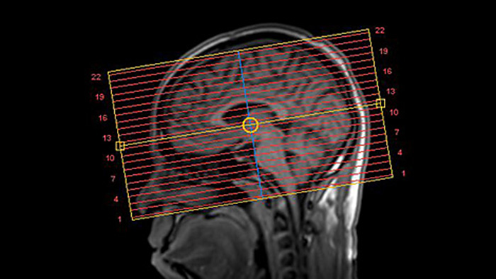 SmartExam image